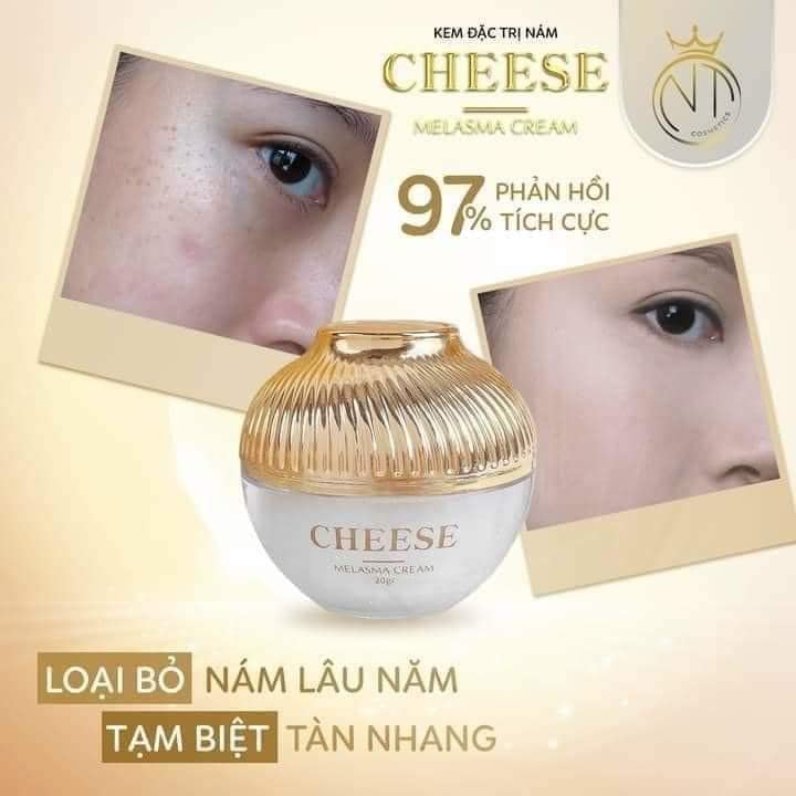 Kem face nám melasma Cheese NT Cosmetics Chính Hãng - 8936206760030