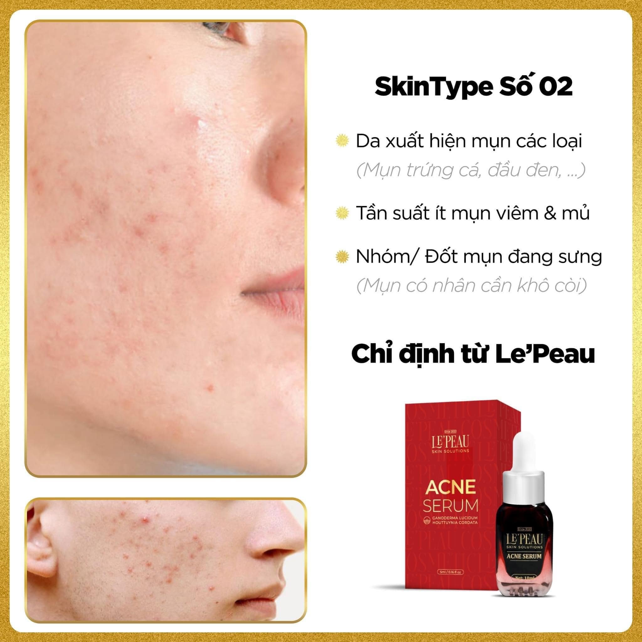 Combo Peel Da Vi Tảo Retinol LePeau Skin Solutions - 8938534922074