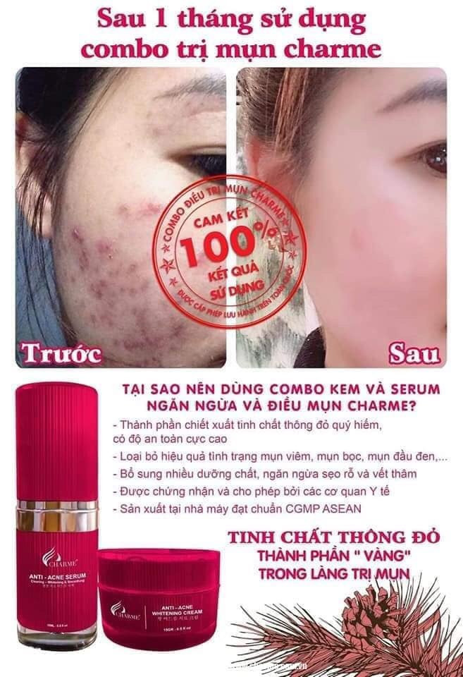 19229-z4294569949526-766be75f00e5ea2fd5e6be4bfc43c98e-4.jpg Kem Face Mụn Hàn Quốc Charme Anti Acne Whitening Cream - 8809273480210