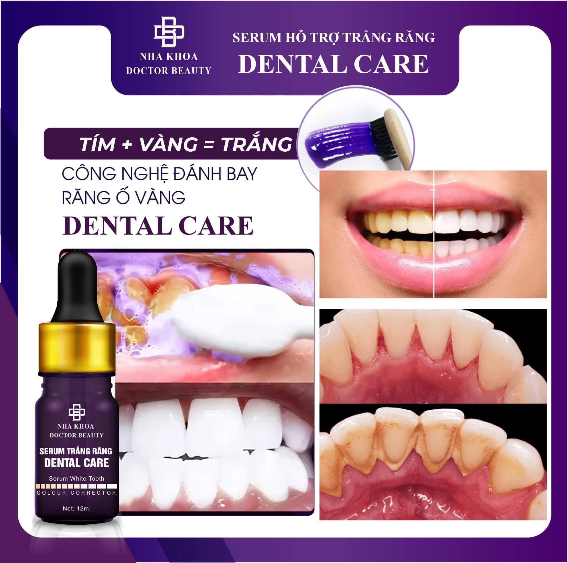 Nguồn sỉ combo 2 Chai Serum Dental Care Hỗ Trợ Trắng Răng Nguồn sỉ combo 2 Chai Serum Dental Care Hỗ Trợ Trắng Răng
