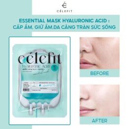 Mặt Nạ Cấp Ẩm Celefit Essential Mask Hyaluronic Acid 23g 10 Miếng - Dành Cho Da Khô Thiếu Ẩm - 8809497562525