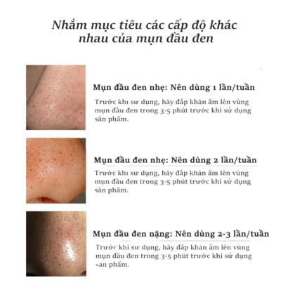 Gel Lột Mụn Nha Đam Okeshop Acne Removal Gel 30g
