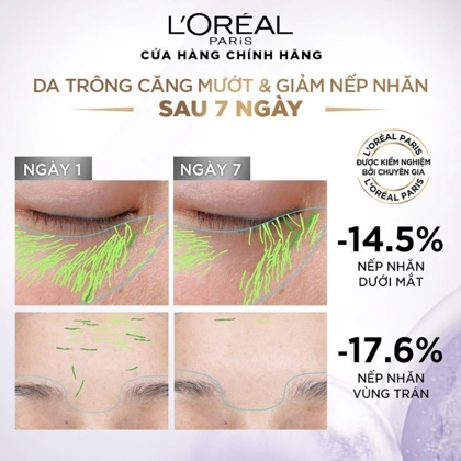 Serum L